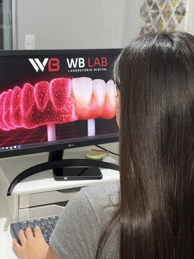 Desenho da gengiva e dos dentes em tela no setor digital do WB LAB